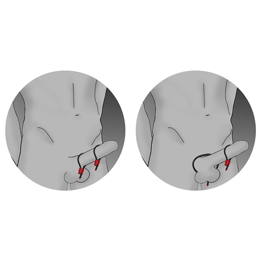 ELECTRASTIM – PRESTIGE ELECTRA LOOPS ADJUSTABLE COCK RINGS BLACK